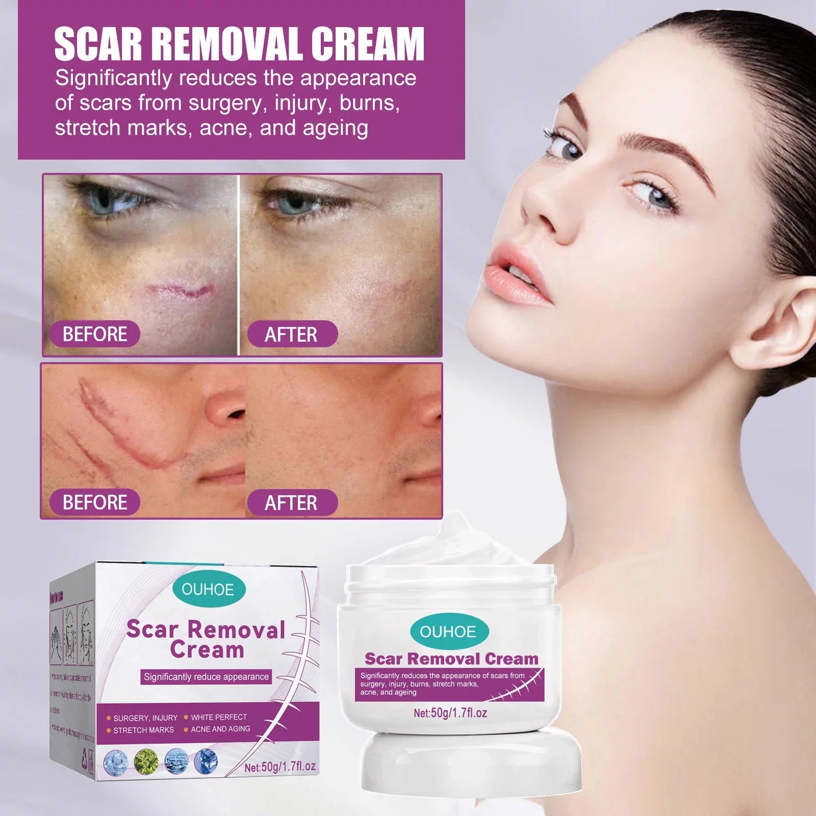 Scar Scar Removal Repair Scar Skin 50ml Repair Cream 2PCS and Cream Removal
