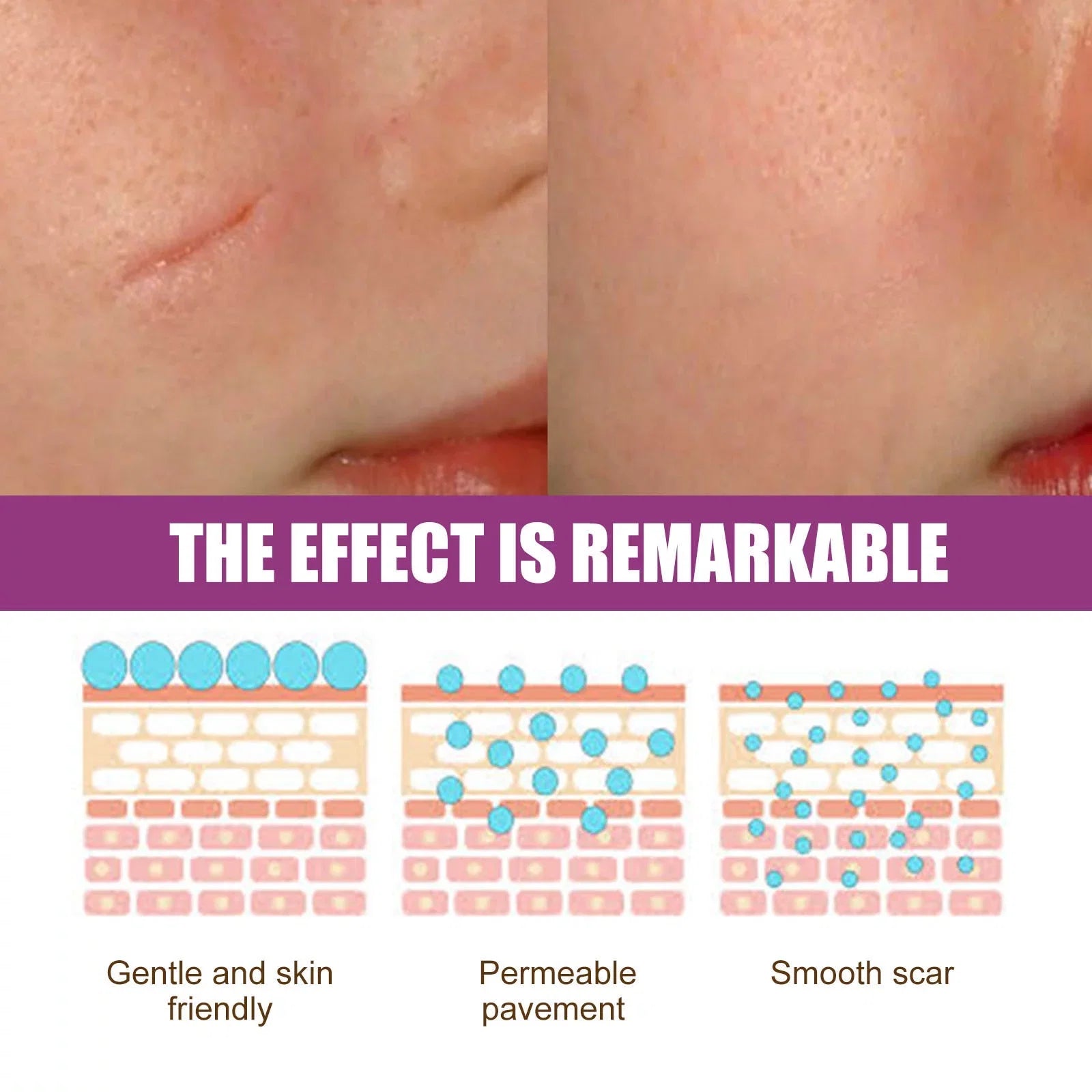 Scar Scar Removal Repair Scar Skin 50ml Repair Cream 2PCS and Cream Removal