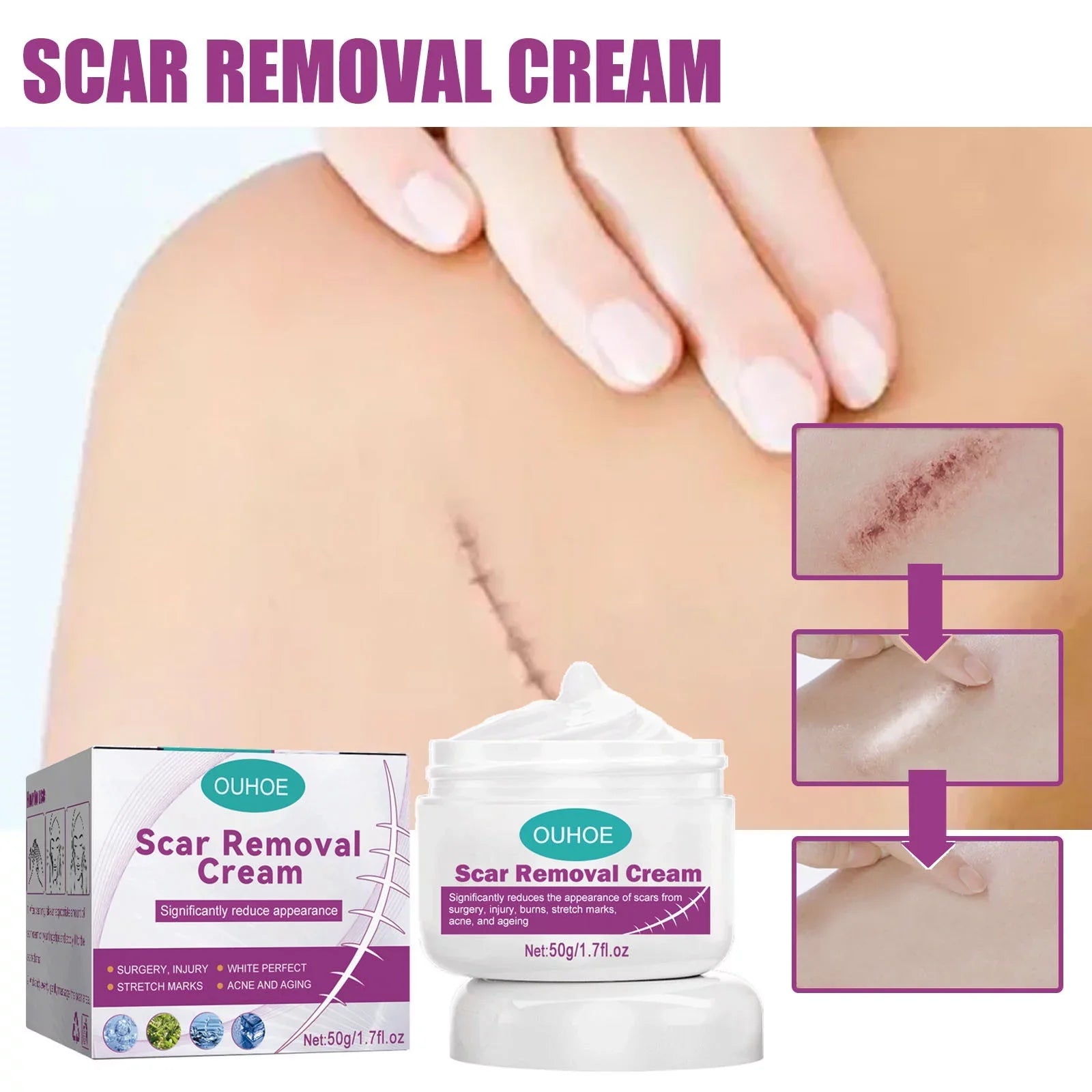 Scar Scar Removal Repair Scar Skin 50ml Repair Cream 2PCS and Cream Removal