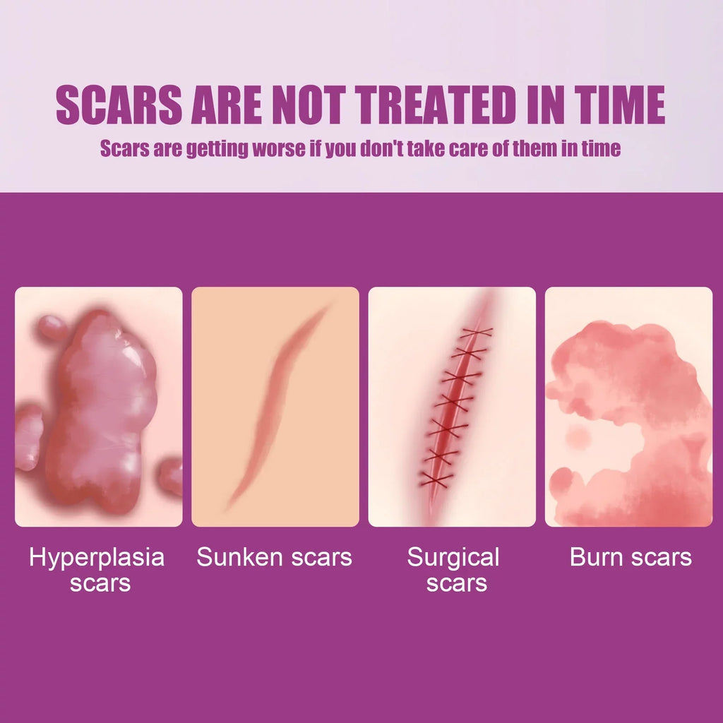 Scar Scar Removal Repair Scar Skin 50ml Repair Cream 2PCS and Cream Removal