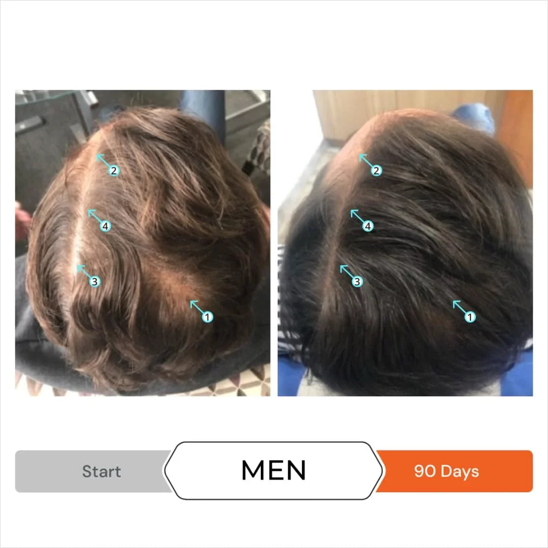 Shampoo Men fl Women, Thickening Hair oz) Support Conditioner Growth, Blocker (7 Volumizing, Strengthening, Thinning Shampoo for by Conditioner DHT DS for - Laboratories Hair and Revita and and